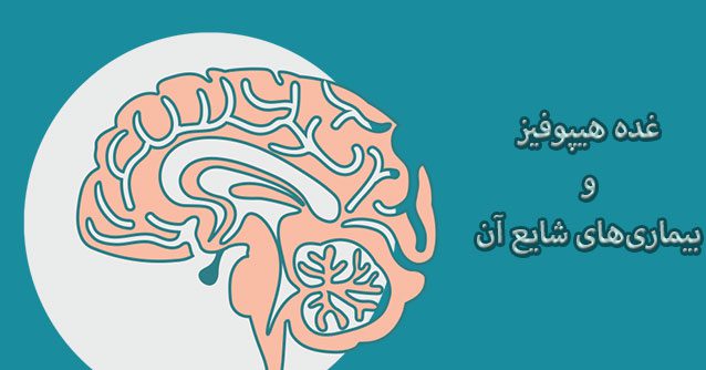 معافیت غده هیپوفیز معافیت غده هیپوفیز ۱۴۰۳