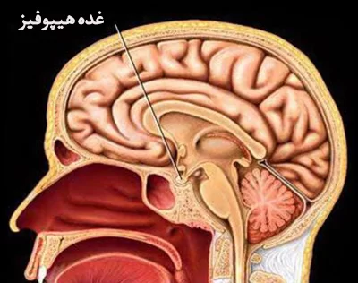 معافیت غده هیپوفیز معافیت غده هیپوفیز ۱۴۰۳
